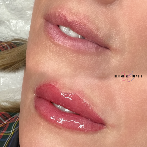 lip gloss touch up near syracuse ny image of before and after pink gloss touch up from definitive beauty