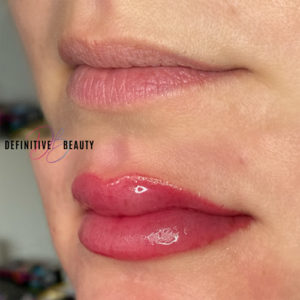 lip-blushing-near-syracuse-ny-image-of-closeup-glossy-lips-from-definitive-beauty-300x300