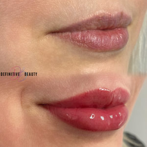 lip-blushing-near-syracuse-ny-image-of-glossy-lips-from-definitive-beauty-300x300